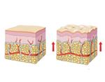 pixwords CELLULITE